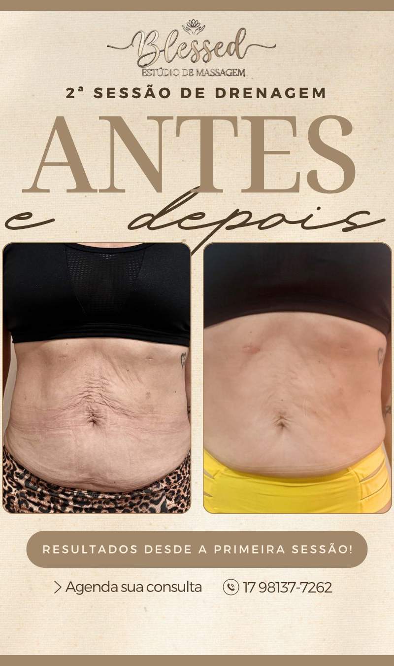 Foto de destaque de Blessed Estúdio de massagem