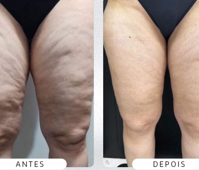 Foto pública 4 de @soniaazevedo.estetica