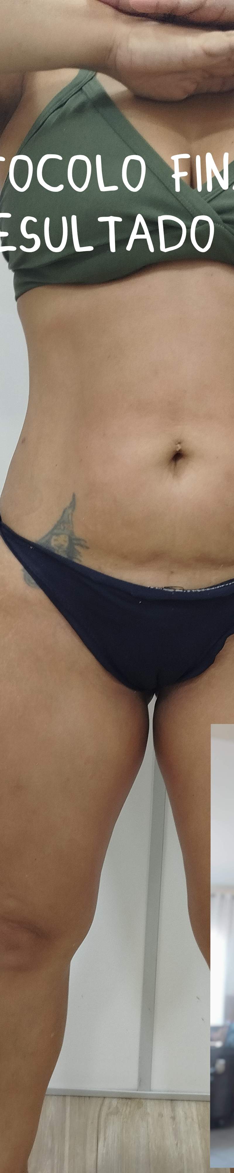 Foto pública 11 de @soniaazevedo.estetica